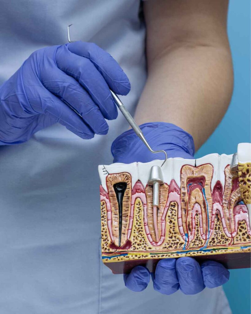 Male dentist demonstrating root canal treatment using a tooth model.