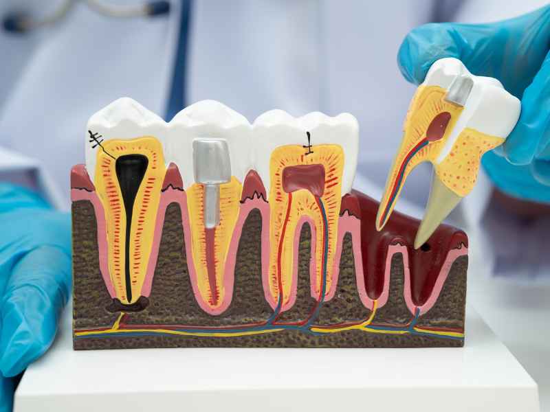 Male dentist pointing to the root canal on a tooth model while explaining the procedure